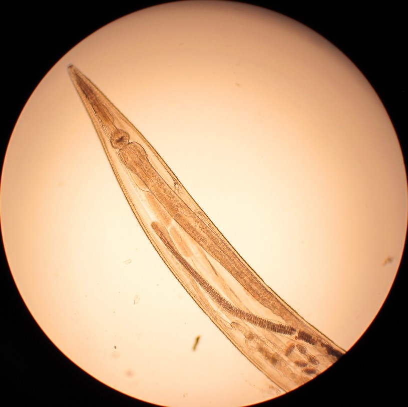 Pinworm under a microscope