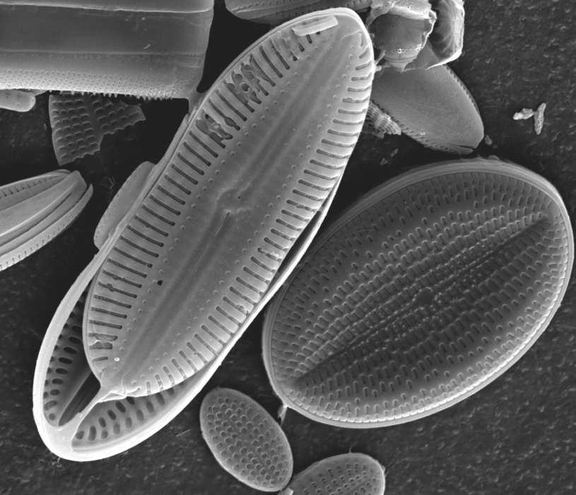 scan of diatoms on white abalone